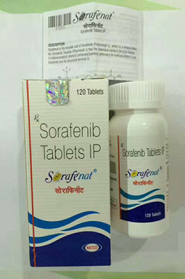 索拉非尼vs立体定向放射治疗+TACE 治疗肝细胞癌