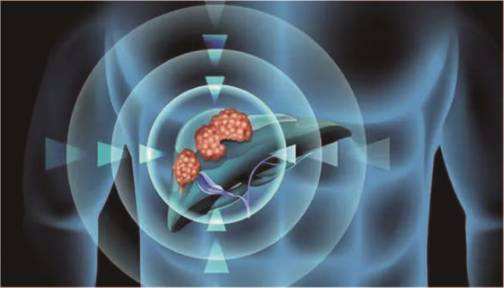 多吉美耐药怎么办？