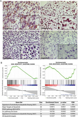 达沙替尼及与卡博替尼联合用于治疗弥漫性脑桥脑胶质瘤的临床前评价