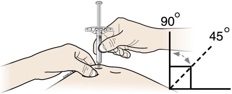 以45-90度角将注射器插入皮肤