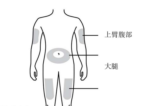 注射部位